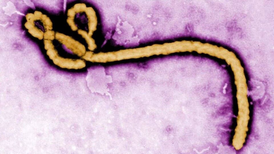 Bilim İnsanları Uyardı: Yeni Virüs Bir Pandemiye Neden Olabilir!